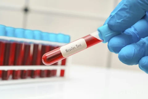 CDC and Pennsylvania: The Conflict of Public Health Messages and Its Risks