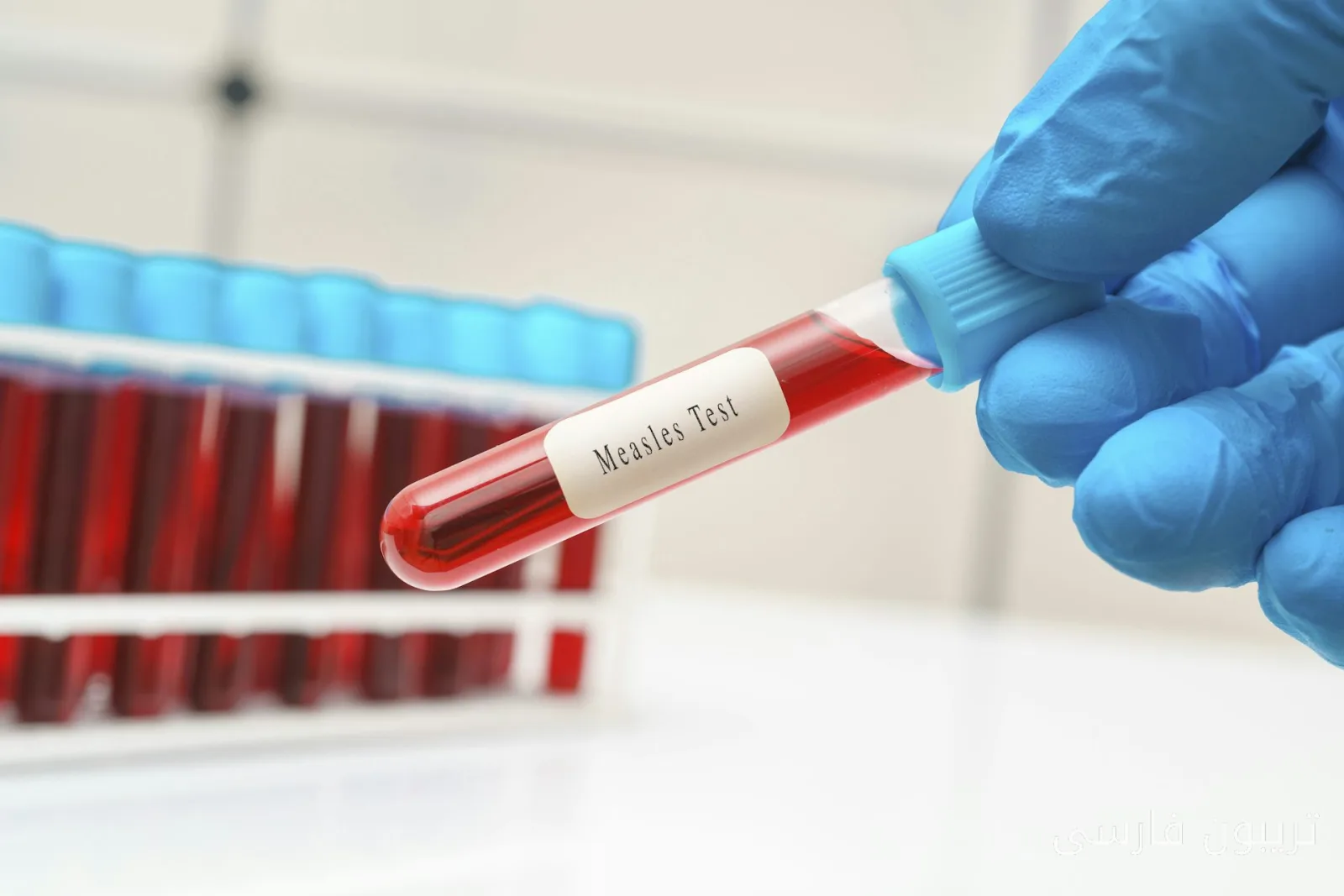 CDC و بنسلفانيا: تضاد رسائل الصحة العامة ومخاطرها